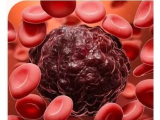 hematologist-doctor-in-hyderabad-small-0