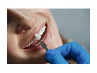 advanced-dental-implant-clinic-in-chetla-for-perfect-smile-small-0