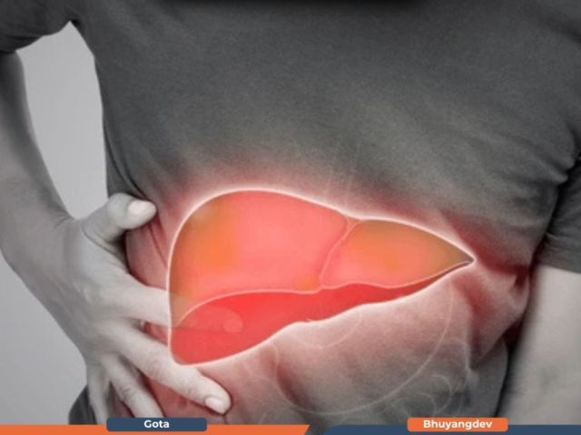 personalized-liver-transplant-treatment-at-gastro1-hospital