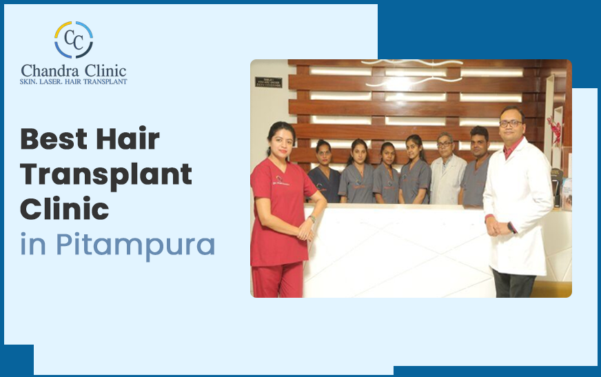get-natural-hair-transplant-in-delhi-by-expert-surgeons-big-0