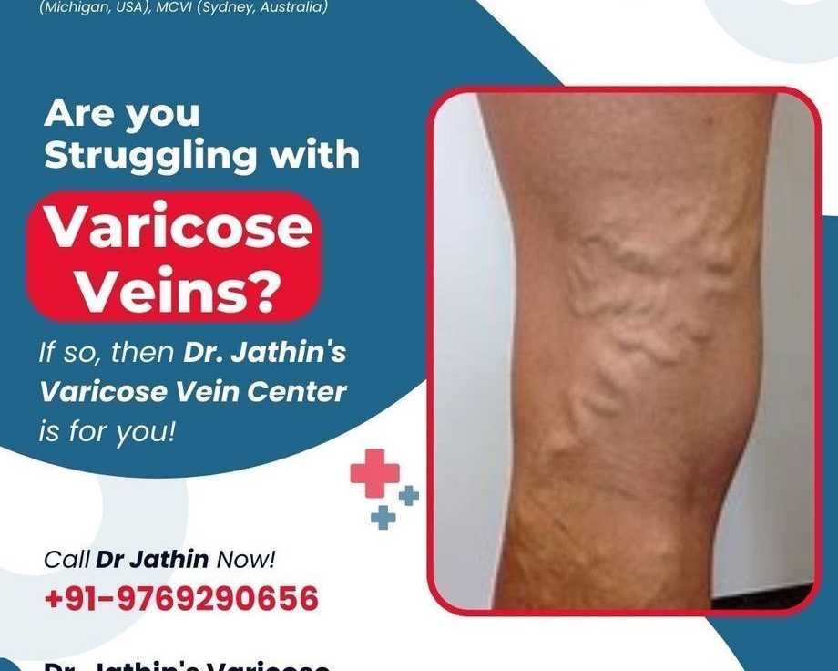 comprehensive-vein-treatment-for-improved-leg-health