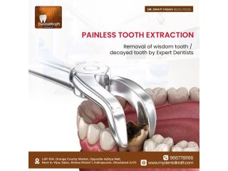 best-dentist-for-tooth-extraction-in-indirapuram-for-safe-care-small-0