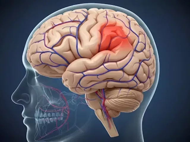 comprehensive-guide-to-brain-hemorrhage-treatment