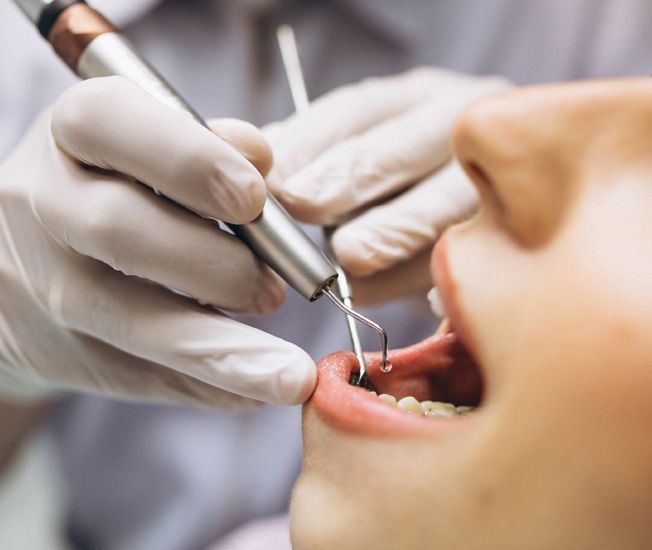 best-dental-clinic-in-trivandrum-for-smile-makeovers-big-0