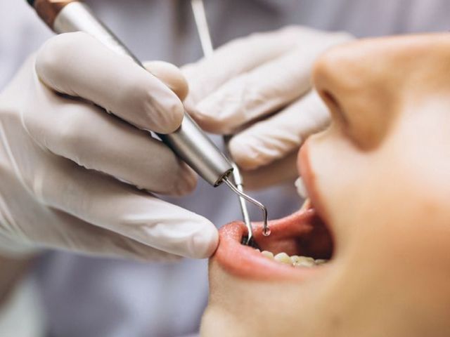 best-dental-clinic-in-trivandrum-for-smile-makeovers