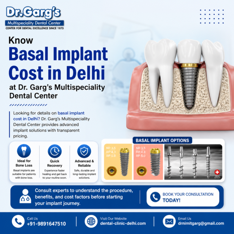 know-basal-implant-cost-in-delhi-at-dr-gargs-dental-center-big-0