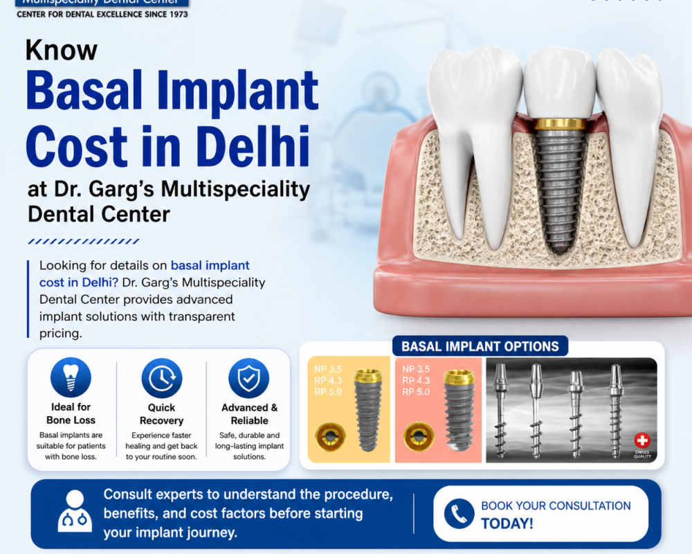 know-basal-implant-cost-in-delhi-at-dr-gargs-dental-center