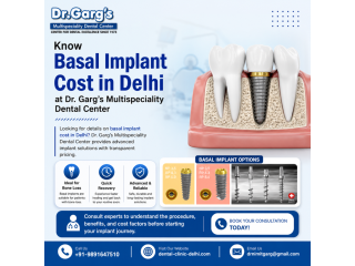 know-basal-implant-cost-in-delhi-at-dr-gargs-dental-center-small-0