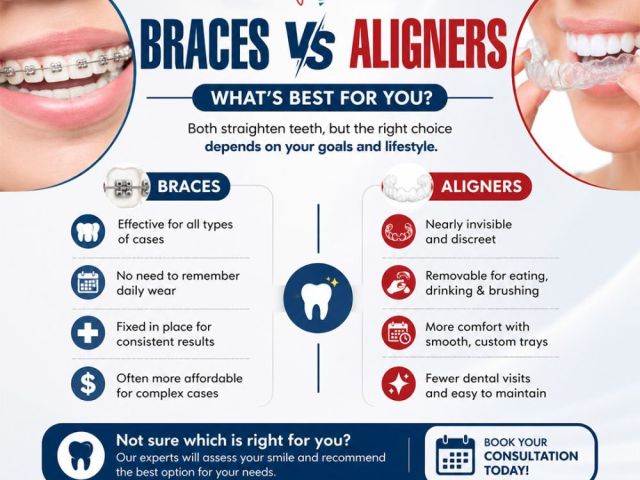clear-braces-near-me-for-discreet-teeth-alignment