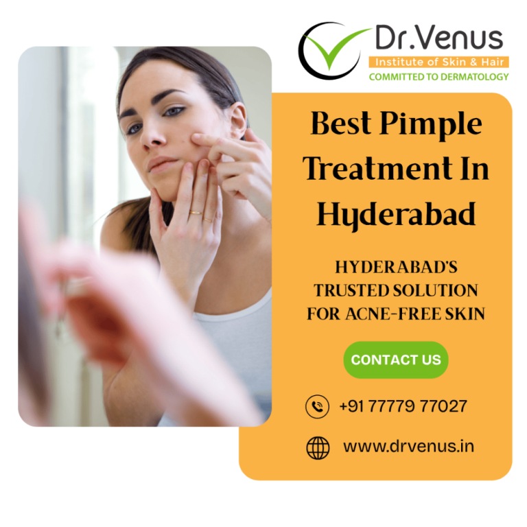 top-rated-pimple-treatment-center-in-hyderabad-dr-venus-big-0