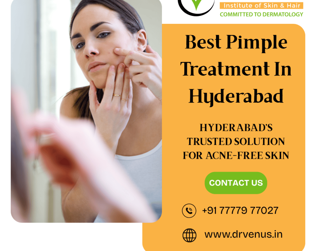 top-rated-pimple-treatment-center-in-hyderabad-dr-venus