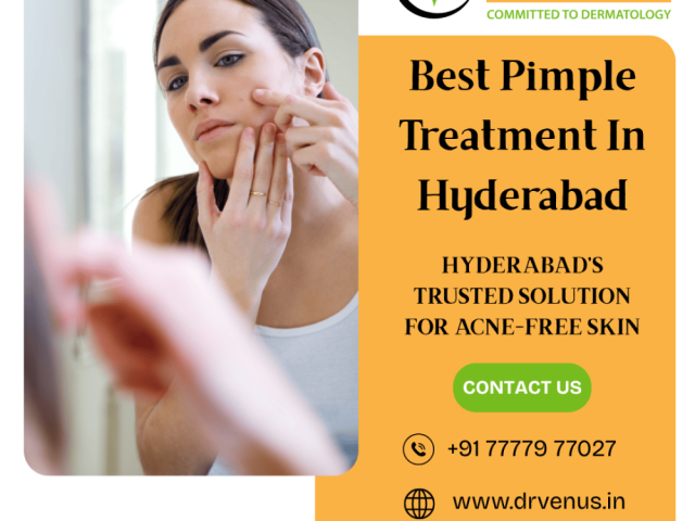 top-rated-pimple-treatment-center-in-hyderabad-dr-venus