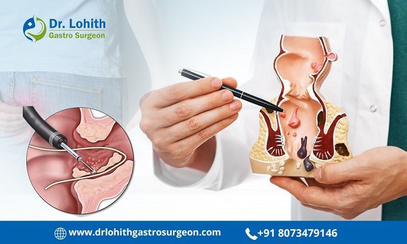 get-reliable-fistula-treatment-in-sarjapur-road-big-0