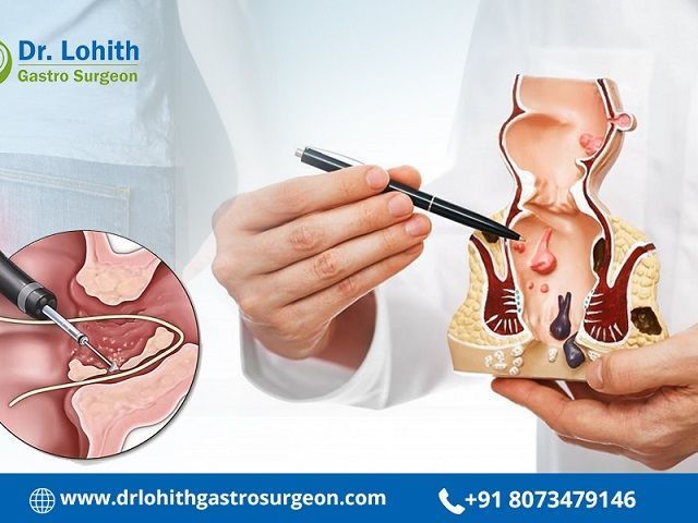 get-reliable-fistula-treatment-in-sarjapur-road