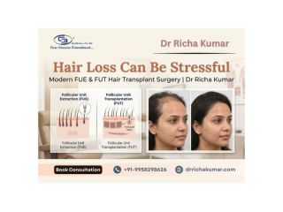 modern-fue-fut-hair-transplant-dr-richa-kumar-small-0