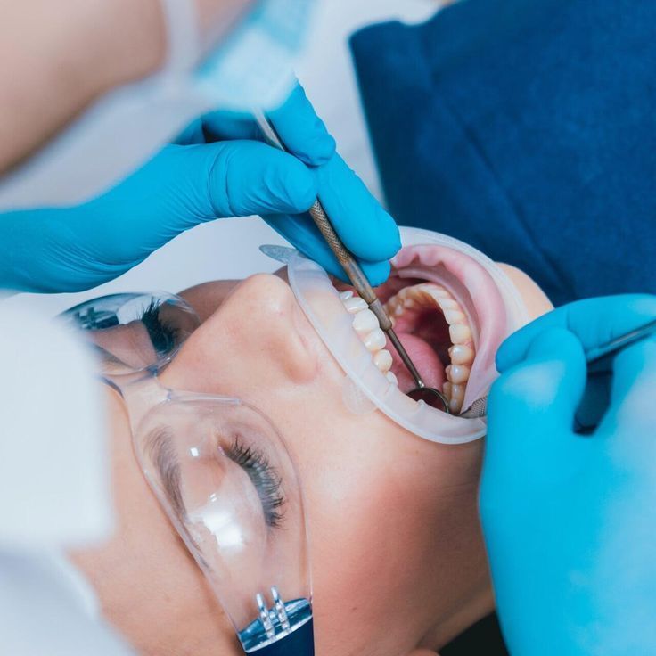 root-canal-clinic-in-ahmadabad-pain-free-rct-treatment-big-0