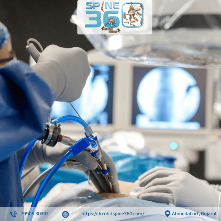 latest-endoscopic-spine-care-by-dr-rohit-thaker-ahmedabad-big-0