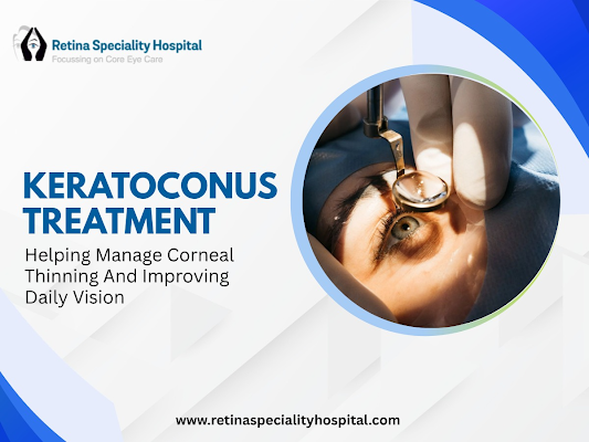 advanced-keratoconus-care-by-eye-treatment-experts