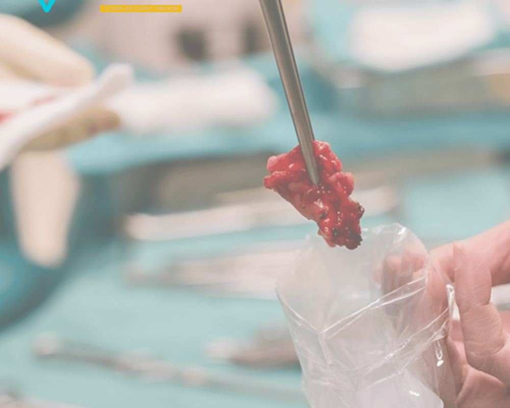 trusted-cancer-treatment-by-the-best-cancer-surgeon-in-ahmedabad