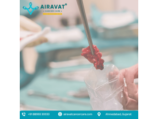 trusted-cancer-treatment-by-the-best-cancer-surgeon-in-ahmedabad-small-0