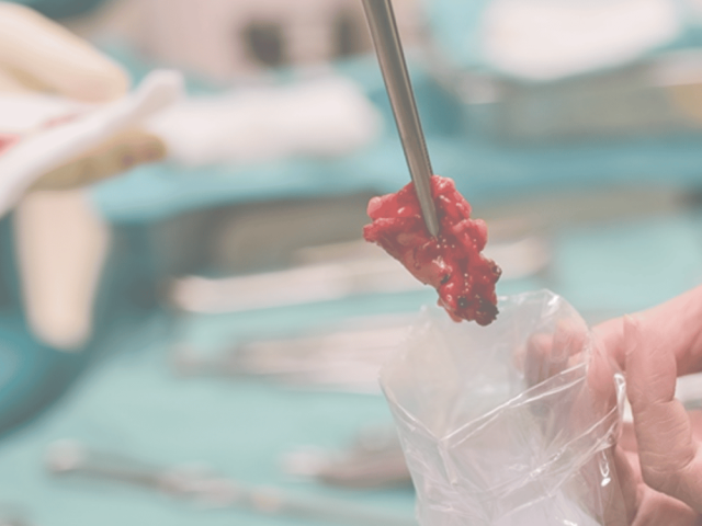 trusted-cancer-treatment-by-the-best-cancer-surgeon-in-ahmedabad
