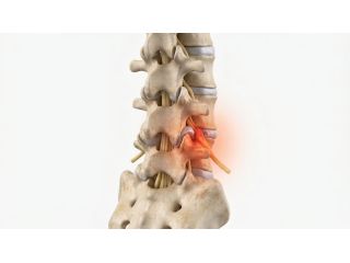 spine-specialist-in-ludhiana-for-advanced-back-spine-care-small-1