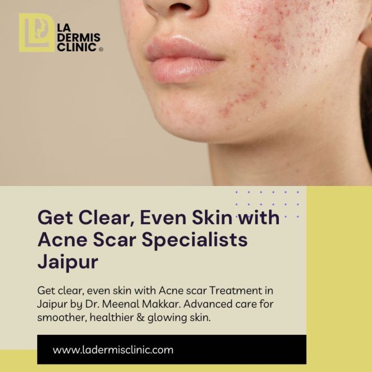get-clear-even-skin-with-acne-scar-specialists-jaipur-big-0
