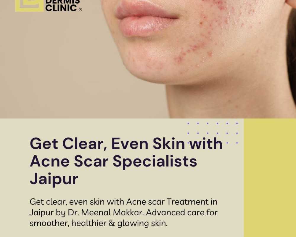 get-clear-even-skin-with-acne-scar-specialists-jaipur
