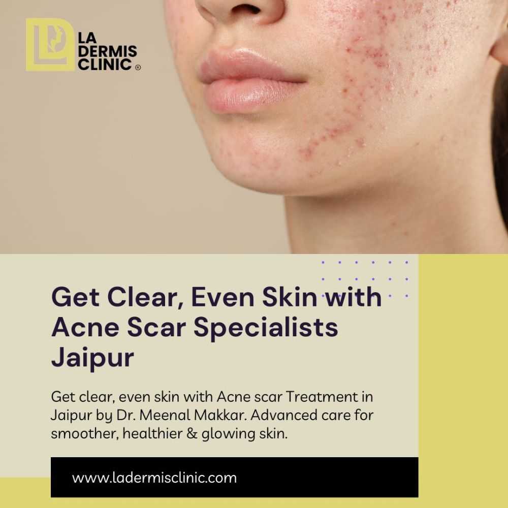 get-clear-even-skin-with-acne-scar-specialists-jaipur-big-0