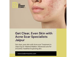 get-clear-even-skin-with-acne-scar-specialists-jaipur-small-0