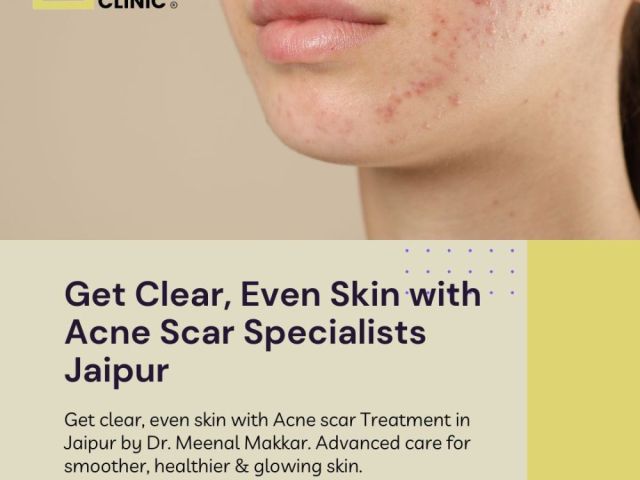 get-clear-even-skin-with-acne-scar-specialists-jaipur