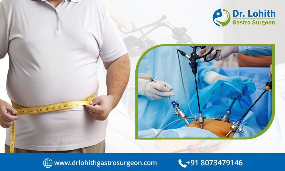 find-the-best-bariatric-surgeon-in-bangalore-today-big-0