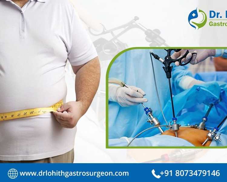find-the-best-bariatric-surgeon-in-bangalore-today