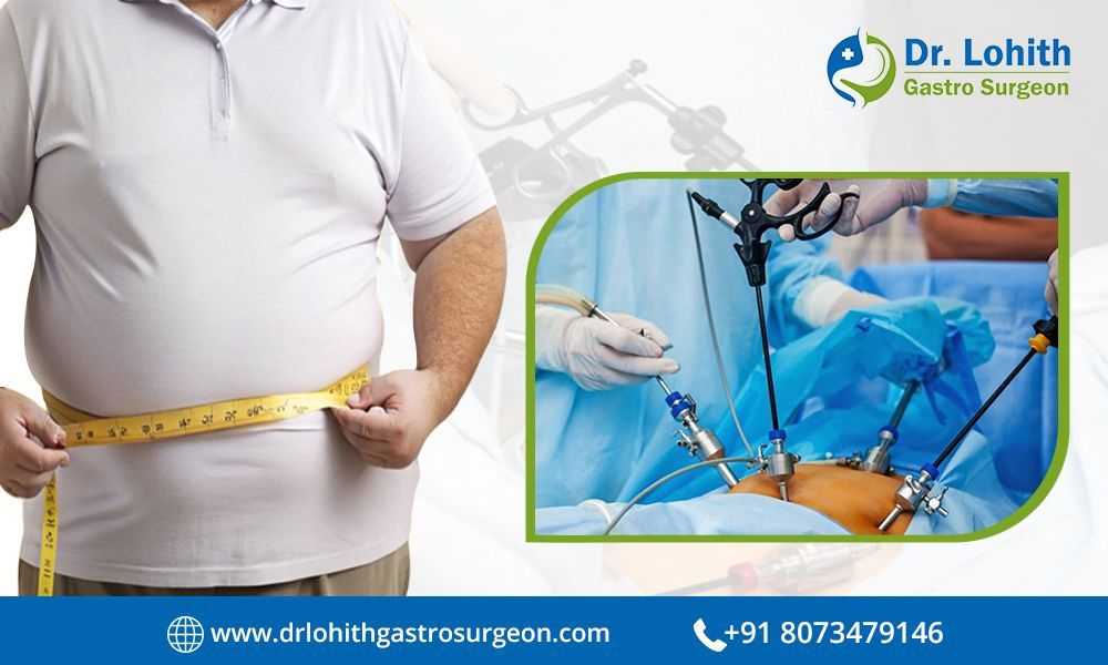 find-the-best-bariatric-surgeon-in-bangalore-today-big-0