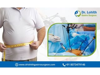 find-the-best-bariatric-surgeon-in-bangalore-today-small-0