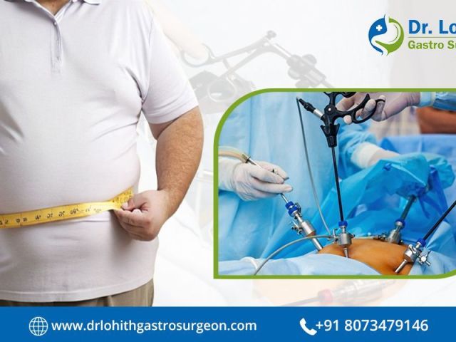find-the-best-bariatric-surgeon-in-bangalore-today