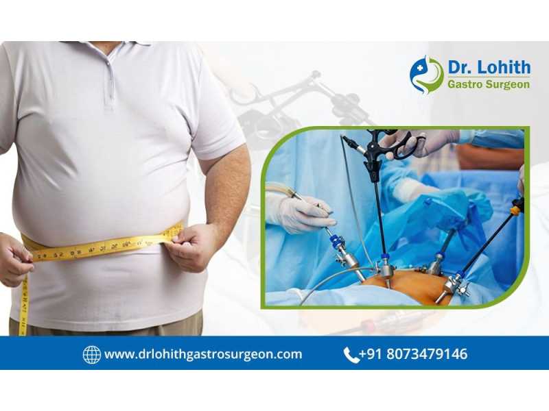 find-the-best-bariatric-surgeon-in-bangalore-today-small-0