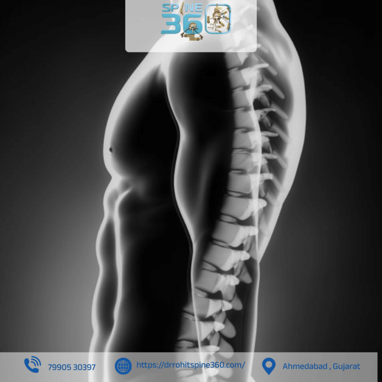 spine-fusion-procedures-by-expert-surgeon-in-ahmedabad-big-0