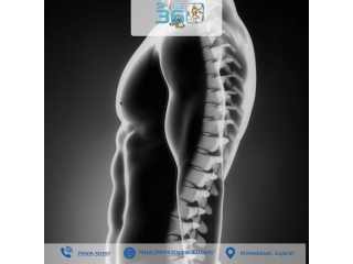 spine-fusion-procedures-by-expert-surgeon-in-ahmedabad-small-0