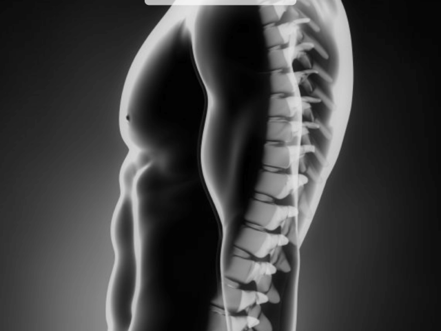 spine-fusion-procedures-by-expert-surgeon-in-ahmedabad