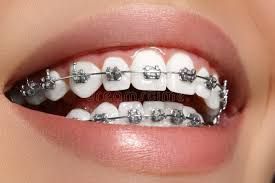 expert-dental-braces-treatment-centre-in-chetla-big-0