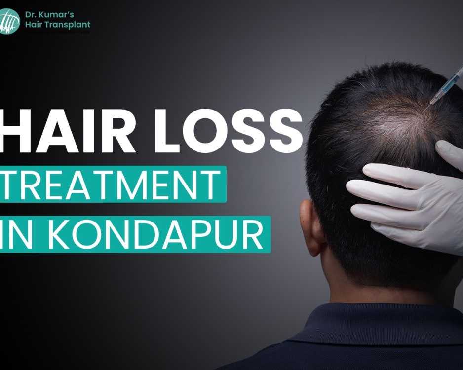 hair-loss-treatment-cost-in-kondapur-expect-at-dr-kumar