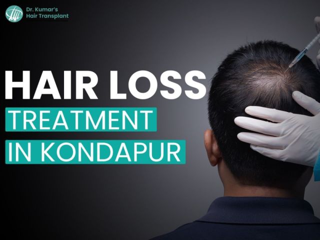 hair-loss-treatment-cost-in-kondapur-expect-at-dr-kumar