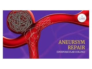 advanced-aneurysm-endovascular-coiling-treatment-at-ir-facilities-small-0