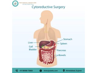 cytoreductive-surgery-in-ahmedabad-for-abdominal-cancer-small-0