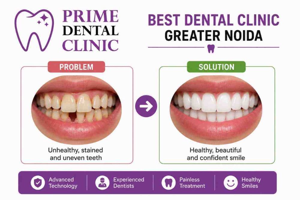 best-dental-clinic-greater-noida-prime-dental-clinic-big-0