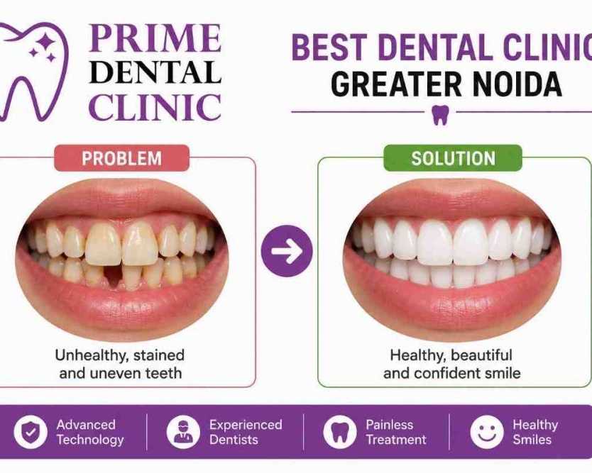 best-dental-clinic-greater-noida-prime-dental-clinic