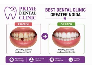 best-dental-clinic-greater-noida-prime-dental-clinic-small-0