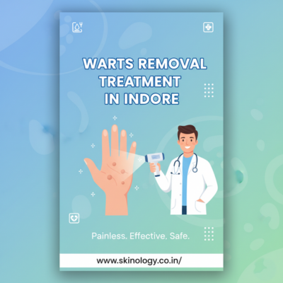 what-causes-warts-and-how-they-spread-easily-on-skin-big-0