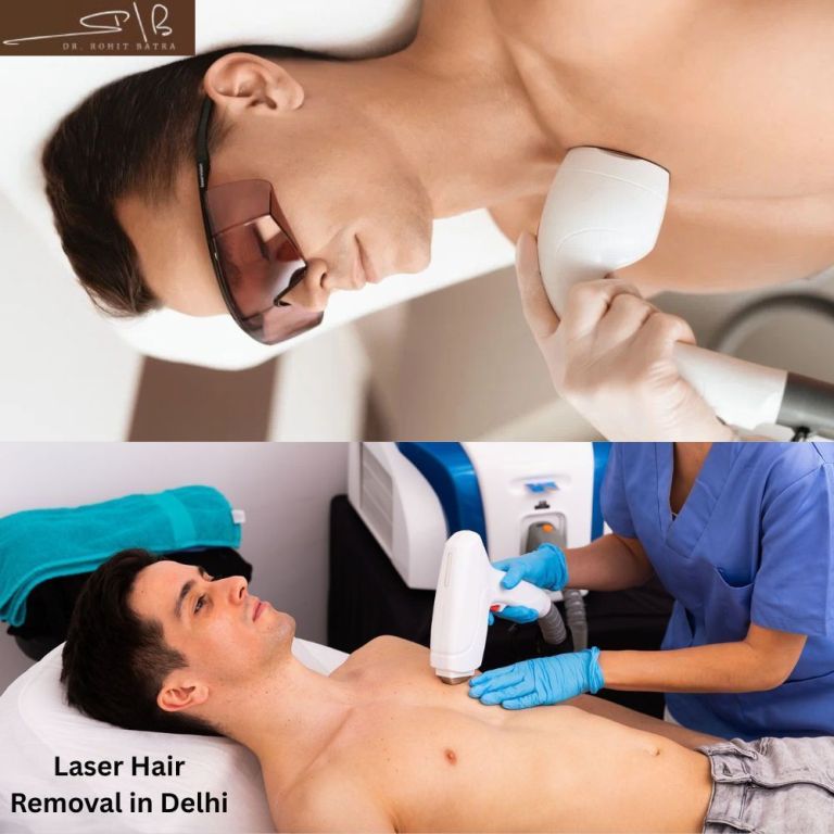 modern-laser-technology-for-effective-hair-reduction-in-delhi-big-0